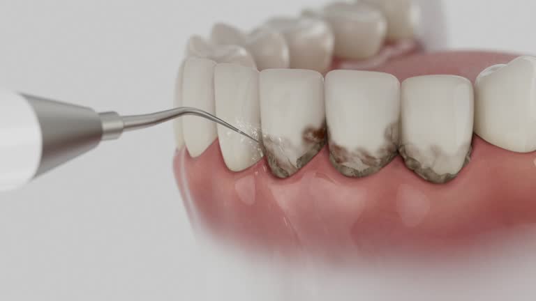 Reliable Dental Implants contractor in Brandon, FL by Smile Center Dentistry